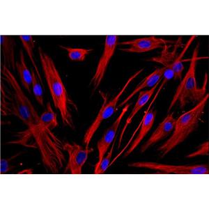 CEM/C1白血病细胞人急性淋巴细胞