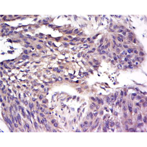 MARC-145[Marc-145非洲绿猴胚胎肾细胞