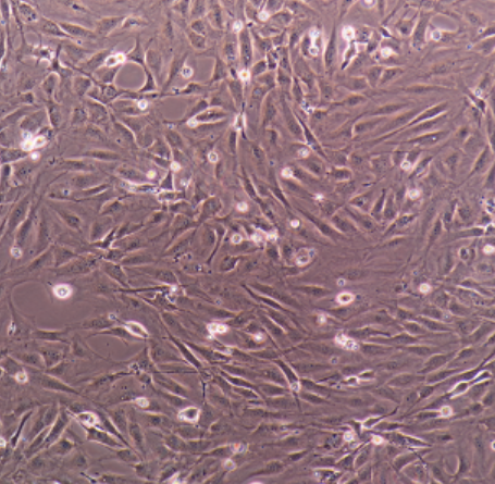 成纤维细胞瘤细胞人胶质母细胞