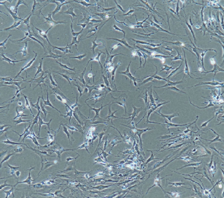 癌間皮瘤(肺原發(fā))NCI-H226肋膜積腋(轉(zhuǎn)移)鱗細(xì)胞