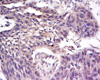 CCRF-CEM白血病细胞人急性淋巴细胞,CCRF-CEM