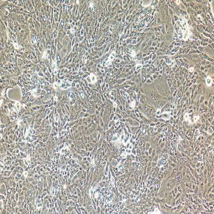 HCC-827肺癌细胞人非小细胞,HCC-827