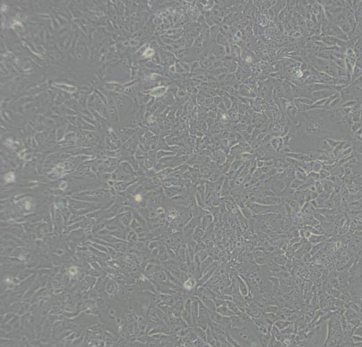 HELA-GFP人宫颈癌细胞-绿色标记,HELA-GFP