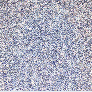 HCV-NS5B中国仓鼠卵巢癌细胞