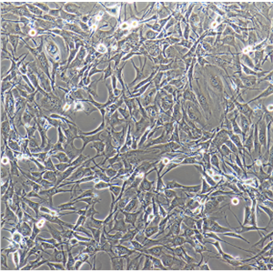 CRT成纤维细胞人神经胶质瘤细胞