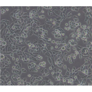 淋巴母细胞癌细胞小鼠肥大细胞