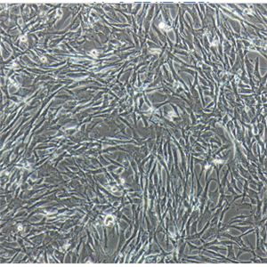 T98G人脑胶质细胞瘤细胞,T98G
