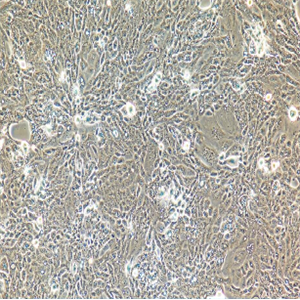 HPBALL人T淋巴细胞白血病细胞