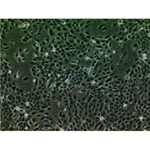 Capan-1人胰腺癌细胞