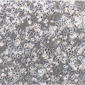 ECV-304人膀胱癌细胞