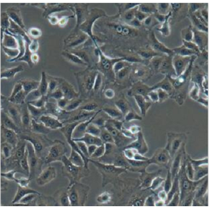 KM12-SM人结肠癌肝转移细胞
