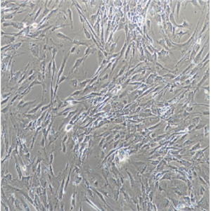 B16-F10--RED小鼠皮肤黑色素瘤细胞-红色标记