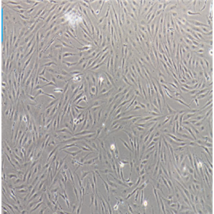 MDA-MB-231-GFP人乳腺癌细胞-绿色标记