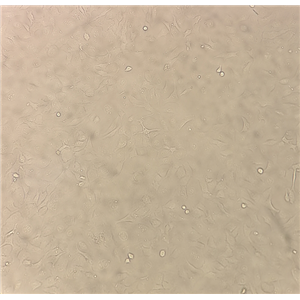 MPC-5小鼠足细胞