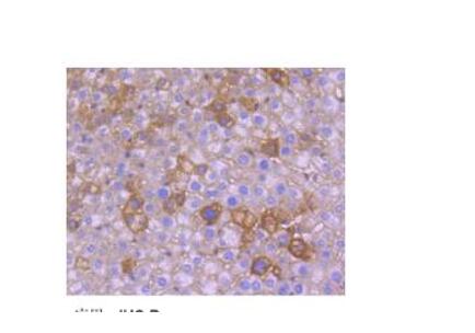 SV40转化COS-7非洲绿猴肾细胞,COS-7