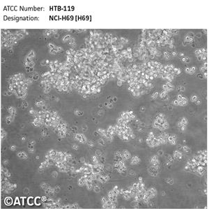 肺癌SBC-2人小细胞