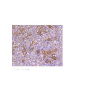 SV40转化COS-7非洲绿猴肾细胞