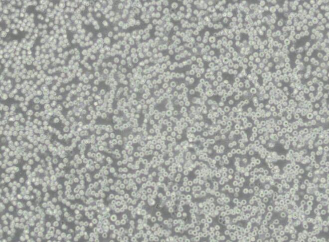 SR-786人间变性大细胞淋巴瘤细胞,SR-786