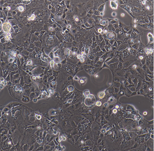 SW1573人肺泡细胞癌细胞,SW1573