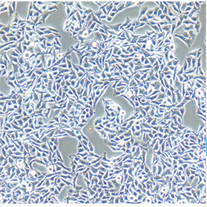 PA-1人卵巢畸胎瘤细胞