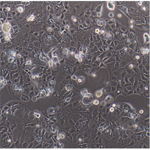 SW1573人肺泡细胞癌细胞