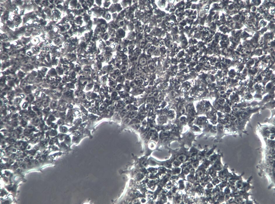 CEM-T4人急性T淋巴细胞白血病细胞,CEM-T4