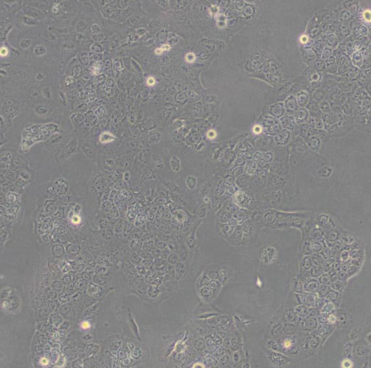 JB6人弥漫大细胞淋巴瘤细胞,JB6