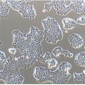 NCI-H1573人非小细胞肺癌细胞