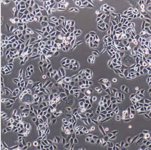 A549-GFP人肺癌细胞带绿色荧光,A549-GFP