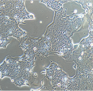 A549/taxol人肺癌細(xì)胞紫杉醇耐藥株,A549/taxol