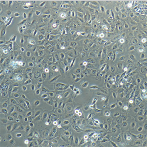 SK-OV-3/DDP人卵巢腺癌顺铂耐药性细胞