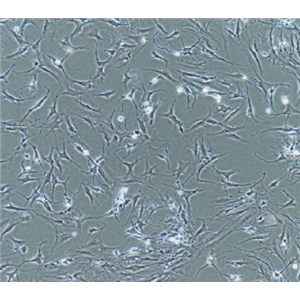 MCF-7/DDP人乳腺癌顺铂耐药性细胞