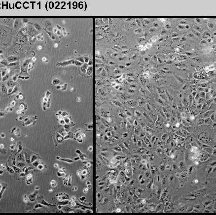 HHCC人肝癌细胞,HHCC