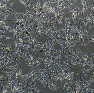 BC-019人乳腺癌细胞,BC-019