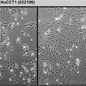 HHCC人肝癌细胞