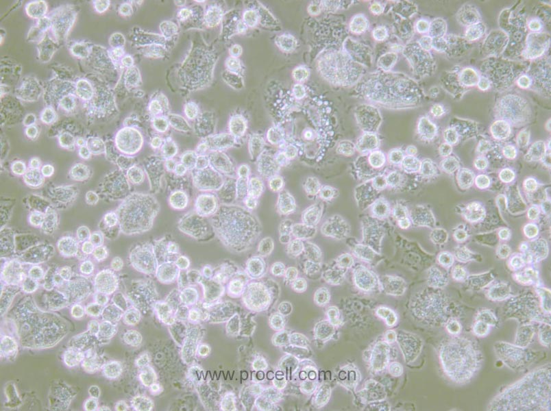 大鼠肺泡巨噬细胞,NR8383