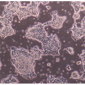 AU565人乳腺癌细胞