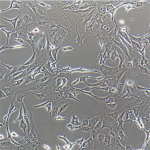 HCC202人乳腺原发性导管癌细胞