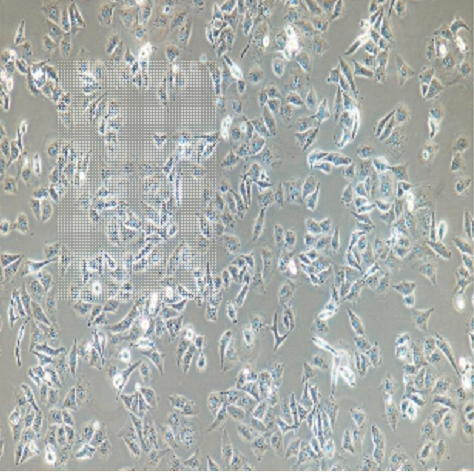 NCI-H1568人非小细胞肺癌细胞,NCI-H1568