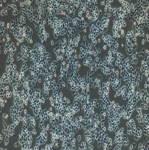 NCI-H146人小细胞肺癌细胞,NCI-H146