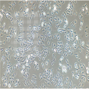 MHCC97-L低转移人肝癌细胞,MHCC97-L