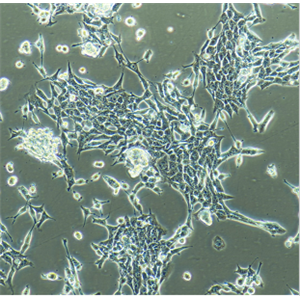NCI-H1581人非小细胞肺癌细胞