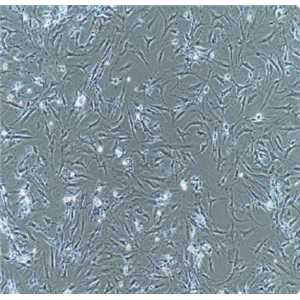 hfl-I人胚肺成纤维细胞