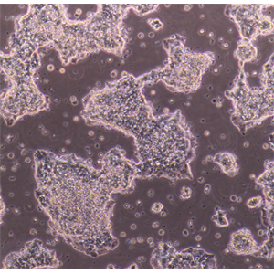 NCI-H2452人間皮瘤細胞