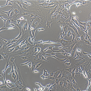 SK-MEL-5人恶性黑色素瘤细胞,SK-MEL-5