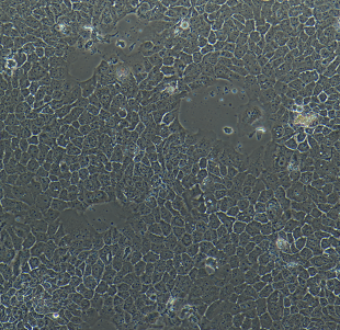 SK-MEL-24人恶性黑色素瘤细胞,SK-MEL-24