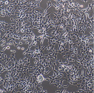 4T1-luc小鼠乳腺癌细胞荧光素酶标记,4T1-luc