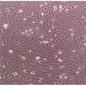 WM-115人黑色素瘤细胞