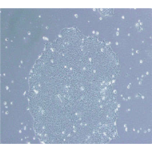 DB人弥漫性大B细胞淋巴瘤细胞