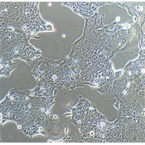 HRC99人直肠腺癌细胞（中分化）
